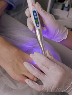 Nehtov&eacute; rovn&aacute;tko (titanov&aacute; nit) 5