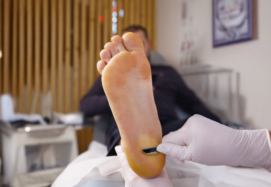 Kart pedicure in prague - safe and professional foot care 4