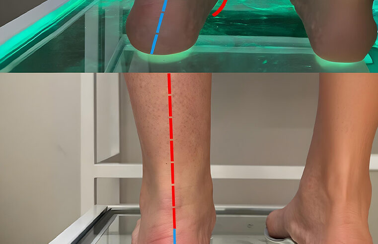 Solution of ingrown nail in 2 months 3
